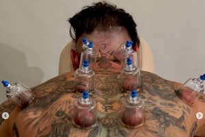 密密麻麻!39岁拉莫斯昨日踢满全场,今日脖子胳膊等多处都在拔罐